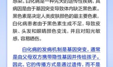 白化病是种传染病、一旦接触患者就会被感染？